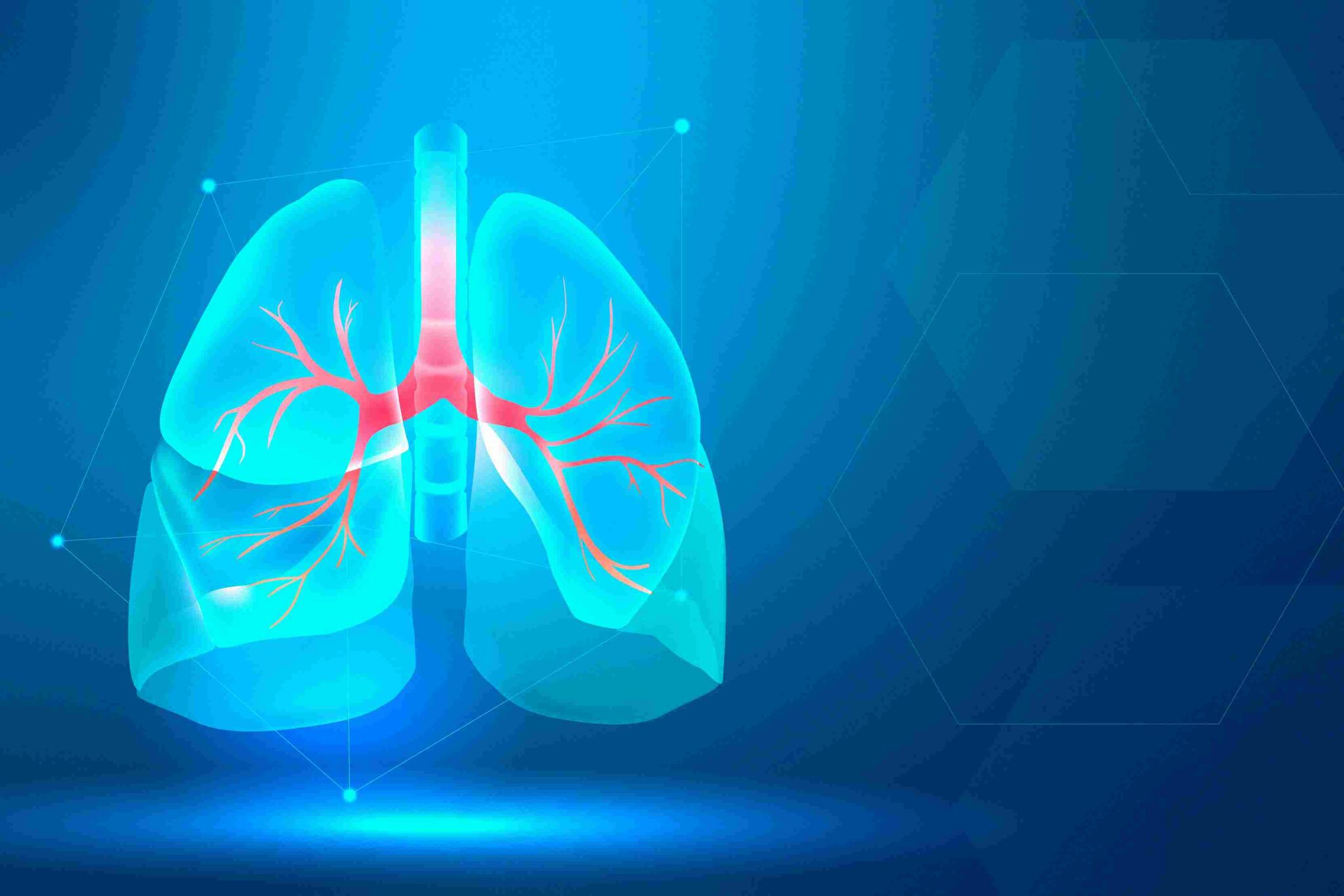 Lung Cancer - Gainall Healthcare